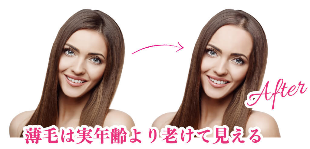 ihairイメージ画像