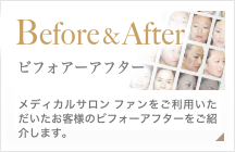 beforeafter