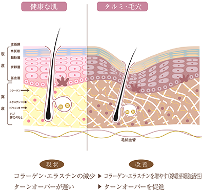 健康な肌とタルミ・毛穴の比較